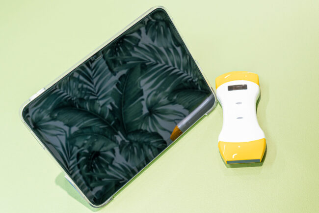 携帯型超音波画像診断装置（ポケットエコー miruco CL5）